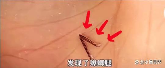 比想象中的更加恶心难怪女性会得妇科病AG真人中国315晚会大爆雷出现了(图14)